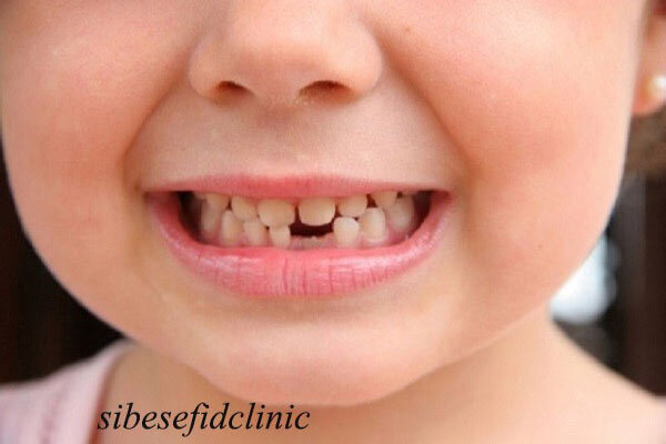کودکان و دندان‌های شیریشان چرا به دندانپزشک نیاز دارند