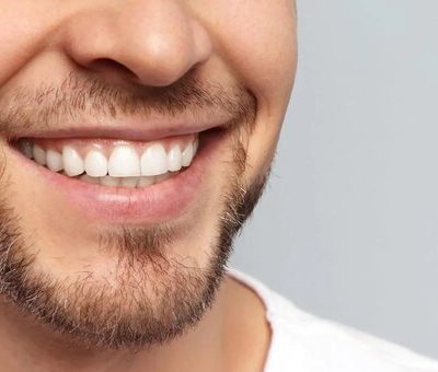 با این سه روش دندان‌های سفیدتری داشته باشید