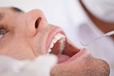 آیا جرم‌گیری به دندان‌ها آسیب می‌رساند؟/ توصیه‌های بهداشتی برای مراقبت از دندان‌ها
