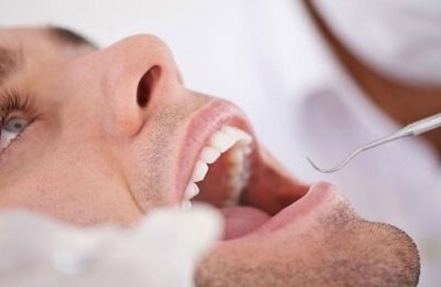 آیا جرم‌گیری به دندان‌ها آسیب می‌رساند؟/ توصیه‌های بهداشتی برای مراقبت از دندان‌ها