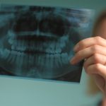 همه چیزهایی که می‌خواهید درباره عکس رادیوگرافی دهان و دندان بدانید.