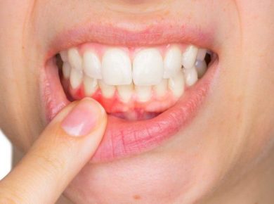 بهداشت ضعیف دهان و دندان