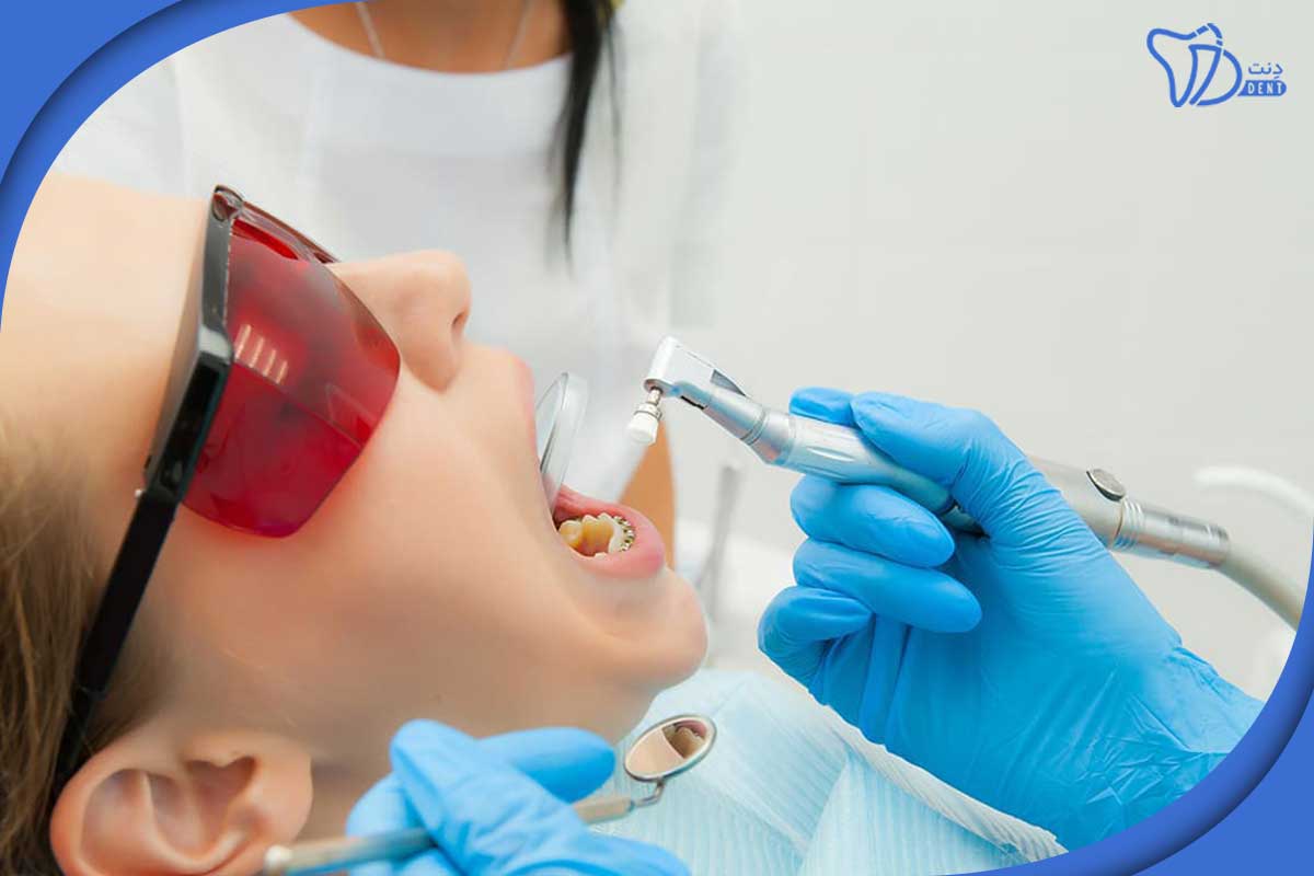 نکاتی برای اولین معاینه دندانپزشکی کودکان