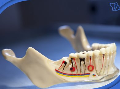 عصب کشی دندان در تهرانپارس