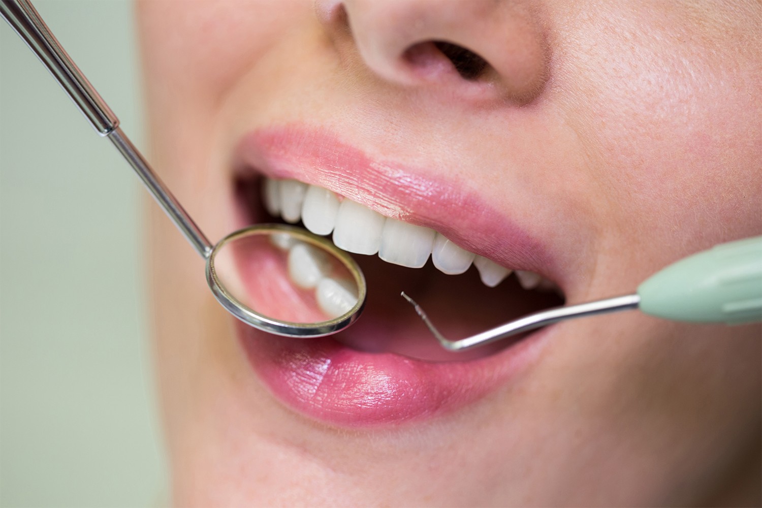 دندانپزشکی صالحی: انتخابی ایده آل برای لمینت‌های دندان در زعفرانیه تهران