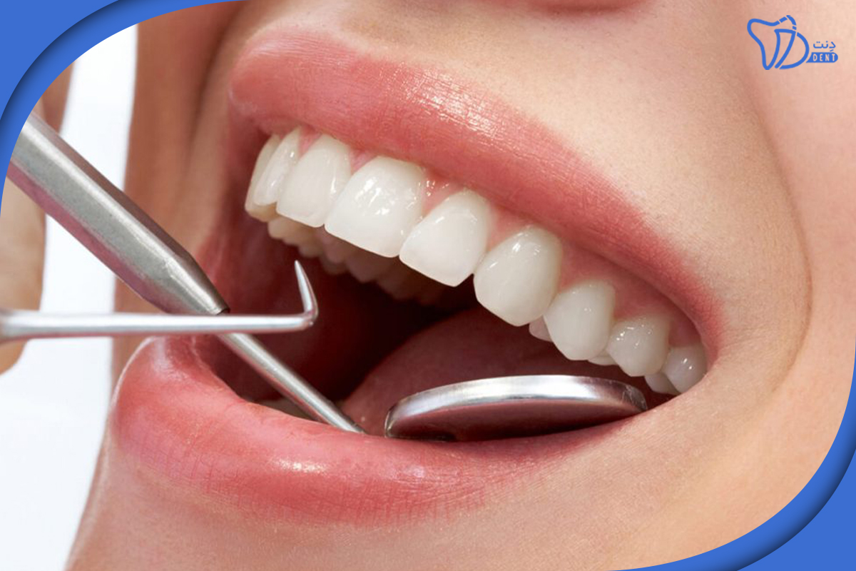فرایند عصب کشی دندان