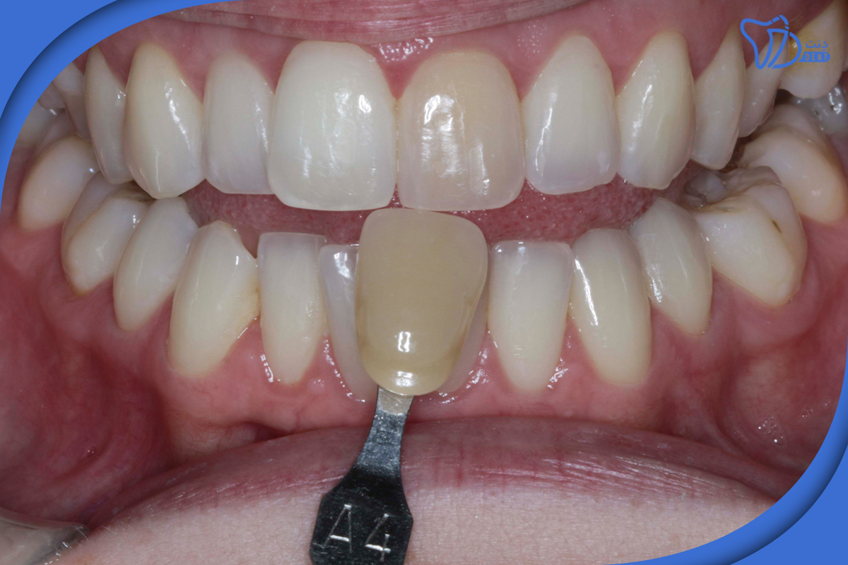 عواملی که در انتخاب دندانپزشک باید در نظر گرفت