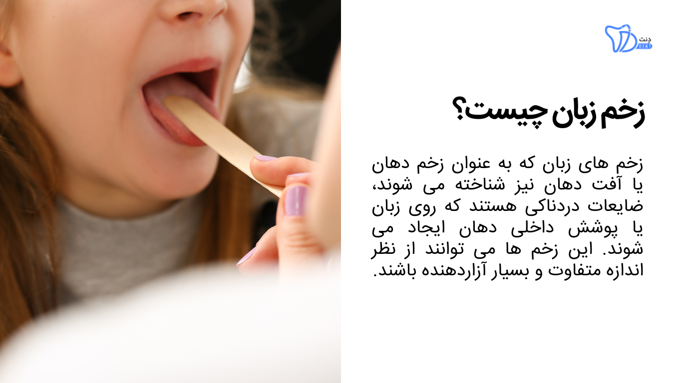 زخم زبان چیست؟